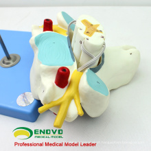 VERTEBRA09 (12393) Medical Science Cervical Vertebrae with Spinal Cord (Modelo Médico, Modelo Anatômico)